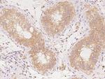 AP2A2 Polyclonal Antibody
