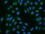 MINT3 Polyclonal Antibody