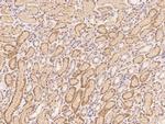 C20orf3 Polyclonal Antibody