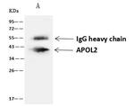 Apolipoprotein L2 Antibody in Immunoprecipitation (IP)
