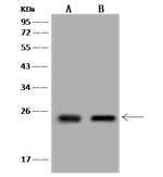 ARFRP1 Antibody in Western Blot (WB)