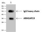 ARHGAP19 Antibody in Immunoprecipitation (IP)