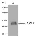ASCC2 Antibody in Immunoprecipitation (IP)
