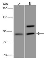 ASCC2 Polyclonal Antibody