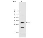 ASCL1 Polyclonal Antibody