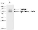 ASMTL Antibody in Immunoprecipitation (IP)