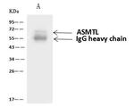 ASMTL Antibody in Immunoprecipitation (IP)