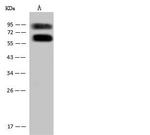 ASMTL Antibody in Western Blot (WB)