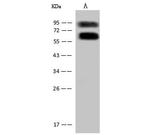 ASMTL Polyclonal Antibody