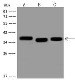 ATF5 Polyclonal Antibody