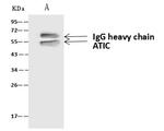 ATIC Antibody in Immunoprecipitation (IP)