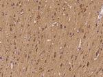 ATP6V1D Antibody in Immunohistochemistry (Paraffin) (IHC (P))