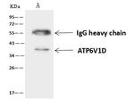 ATP6V1D Antibody in Immunoprecipitation (IP)