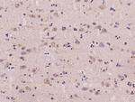 AUP1 Antibody in Immunohistochemistry (Paraffin) (IHC (P))