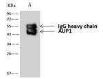 AUP1 Antibody in Immunoprecipitation (IP)