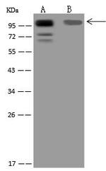 BOP1 Antibody in Western Blot (WB)