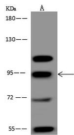 BRD3 Polyclonal Antibody