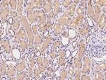 C1orf109 Antibody in Immunohistochemistry (Paraffin) (IHC (P))