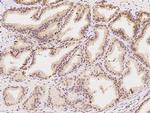 C3orf38 Antibody in Immunohistochemistry (Paraffin) (IHC (P))