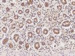 C3orf38 Antibody in Immunohistochemistry (Paraffin) (IHC (P))