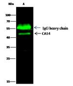 Carbonic Anhydrase XIV Antibody in Immunoprecipitation (IP)
