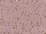 CABP5 Polyclonal Antibody
