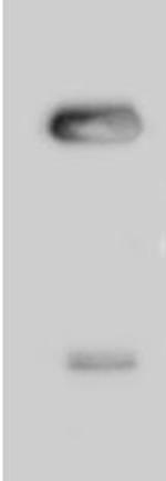 CABP5 Antibody in Immunoprecipitation (IP)