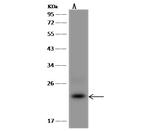 CABP5 Antibody in Western Blot (WB)