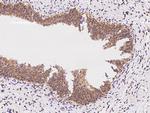 Calcyclin Antibody in Immunohistochemistry (Paraffin) (IHC (P))