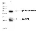 Calcyclin Antibody in Immunoprecipitation (IP)
