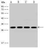 Calcyclin Antibody in Western Blot (WB)