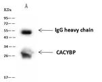 Calcyclin Antibody in Immunoprecipitation (IP)