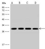 Calcyclin Antibody in Western Blot (WB)