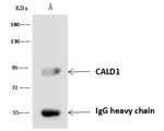 Caldesmon Antibody in Immunoprecipitation (IP)