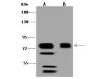 Caldesmon Antibody in Western Blot (WB)