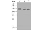 CaMKII alpha Antibody in Western Blot (WB)