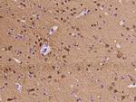 CaMKII alpha Antibody in Immunohistochemistry (Paraffin) (IHC (P))