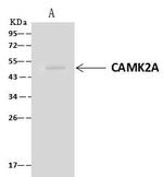 CaMKII alpha Antibody in Immunoprecipitation (IP)