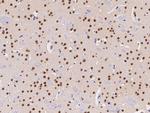 CaMKIV Antibody in Immunohistochemistry (Paraffin) (IHC (P))