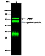 CaMKIV Antibody in Immunoprecipitation (IP)