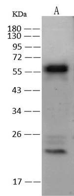 CaMKIV Antibody in Western Blot (WB)