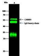 CaMKIV Antibody in Immunoprecipitation (IP)