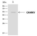 CaMKV Antibody in Immunoprecipitation (IP)