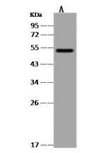 CaMKV Antibody in Western Blot (WB)