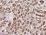 Calpain S1 Antibody in Immunohistochemistry (Paraffin) (IHC (P))