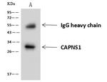 Calpain S1 Antibody in Immunoprecipitation (IP)