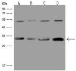CAPZB Polyclonal Antibody