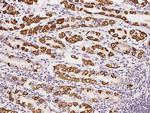 CBF beta Polyclonal Antibody