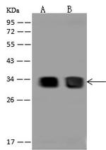 CBR1 Polyclonal Antibody