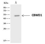 CBWD1 Antibody in Immunoprecipitation (IP)